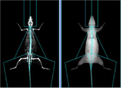 The Effect of Moderate-Intensity Treadmill Exercise on Bone Mass and the Transcription of Peripheral Blood Mononuclear Cells in Ovariectomized Rats